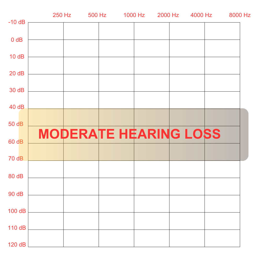 Hearing Loss - Moderate